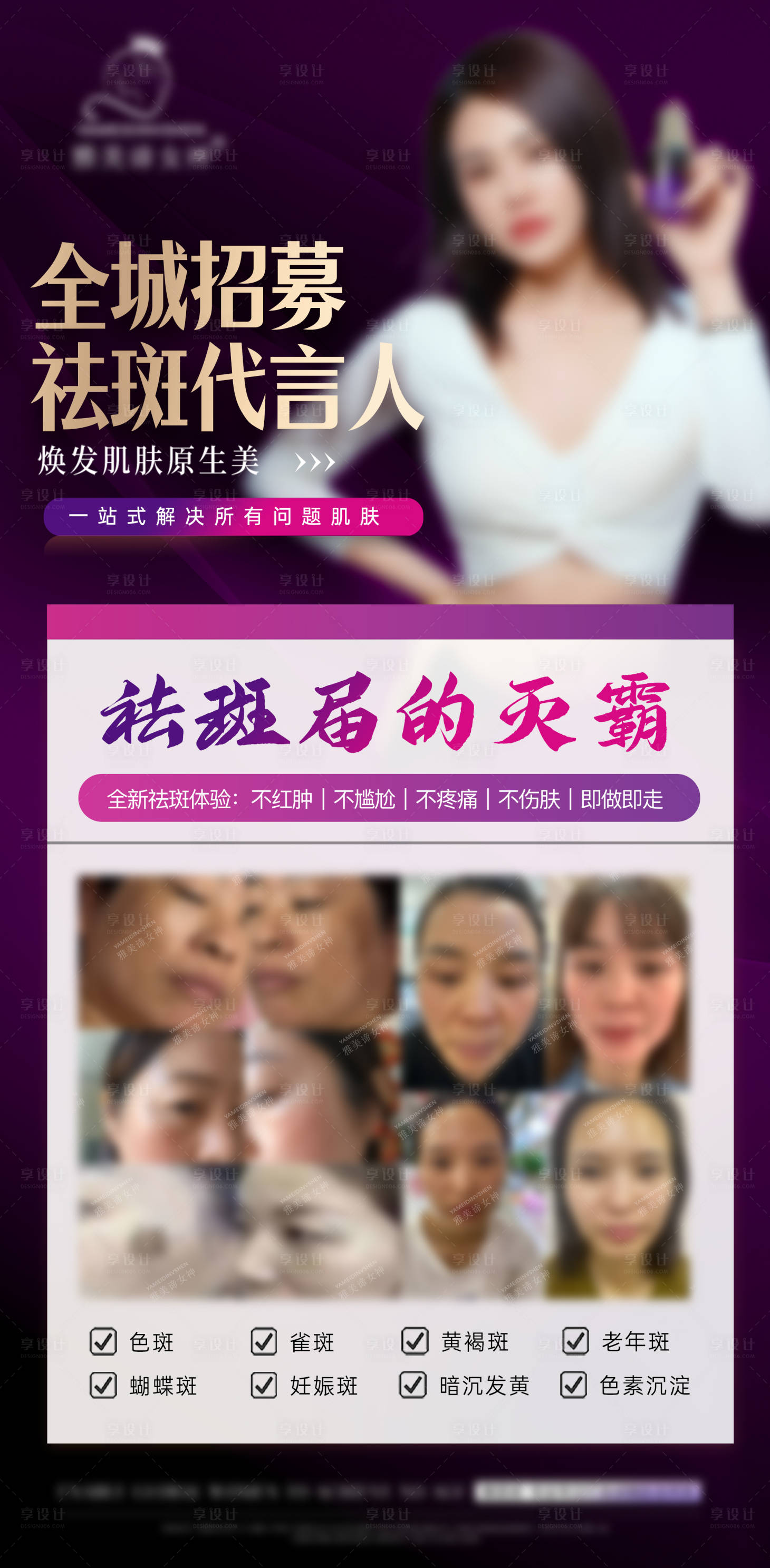 源文件下载【享设计】搜索编号：59520032346587998【美业招募祛斑代言人海报】