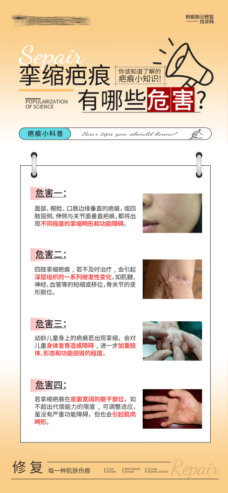 源文件下载【享设计】搜索编号：81620032455343997【挛缩疤痕有哪些危害】