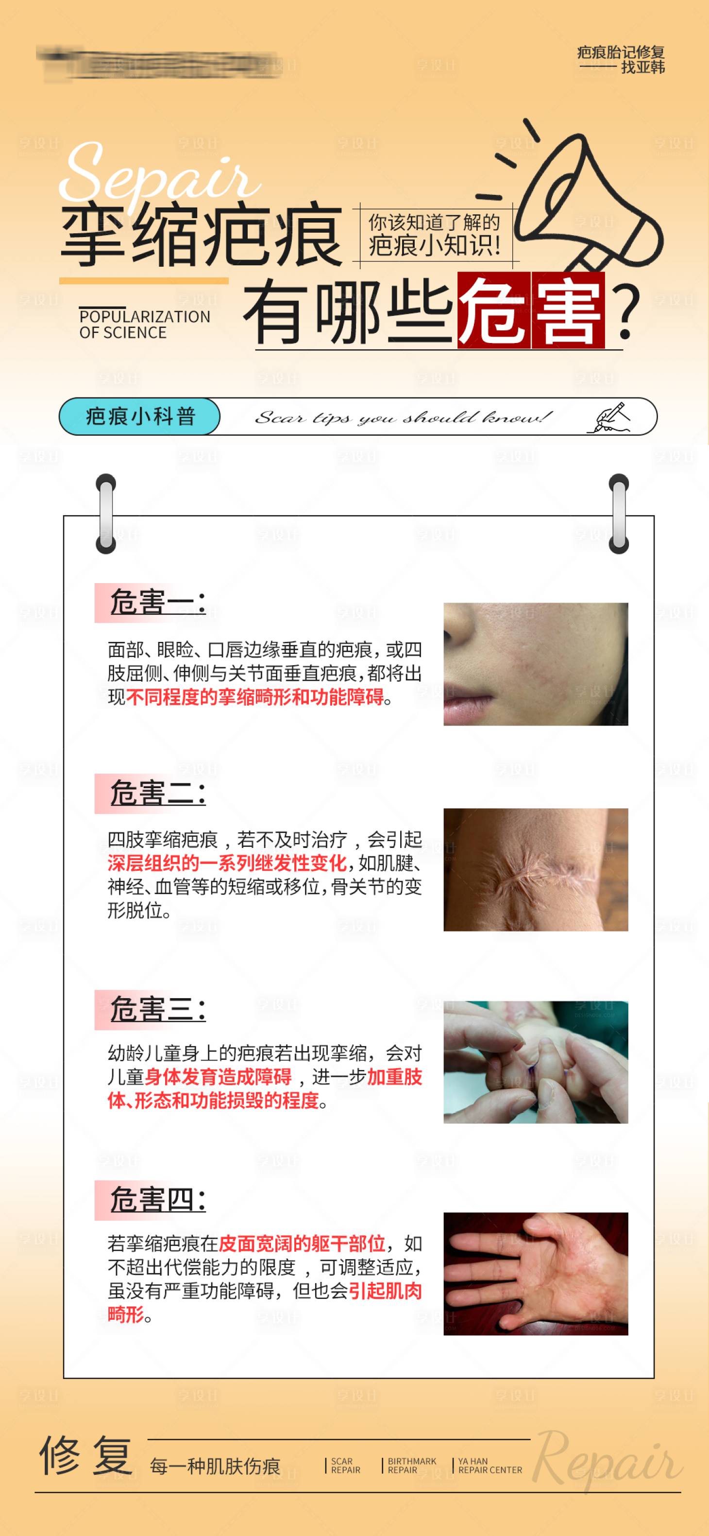 源文件下载【享设计】搜索编号：81620032455343997【挛缩疤痕有哪些危害】