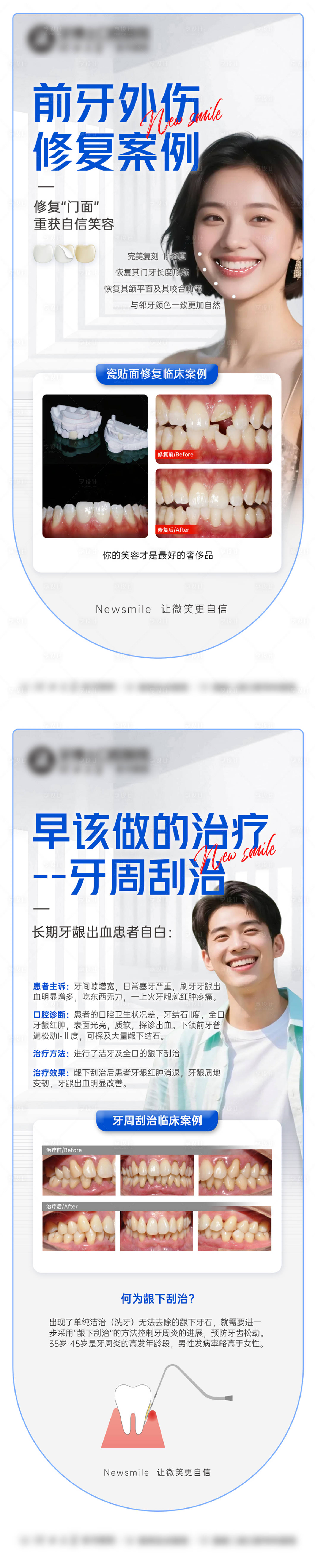 源文件下載【享設計】搜索編號：15620032822456918【口腔案例修復海報】
