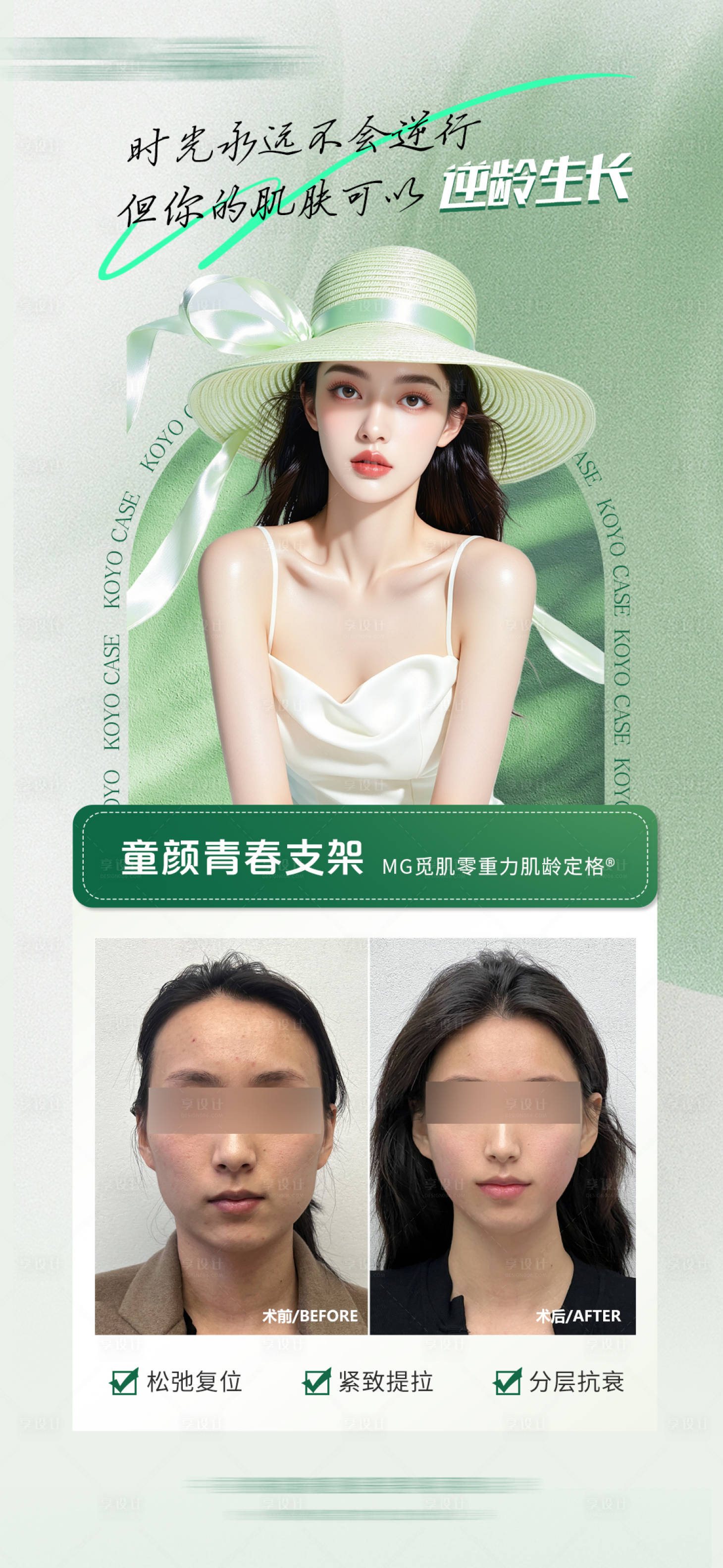 源文件下載【享設(shè)計(jì)】搜索編號：22550032389286567【醫(yī)美面部抗衰童顏青春案例海報(bào)】