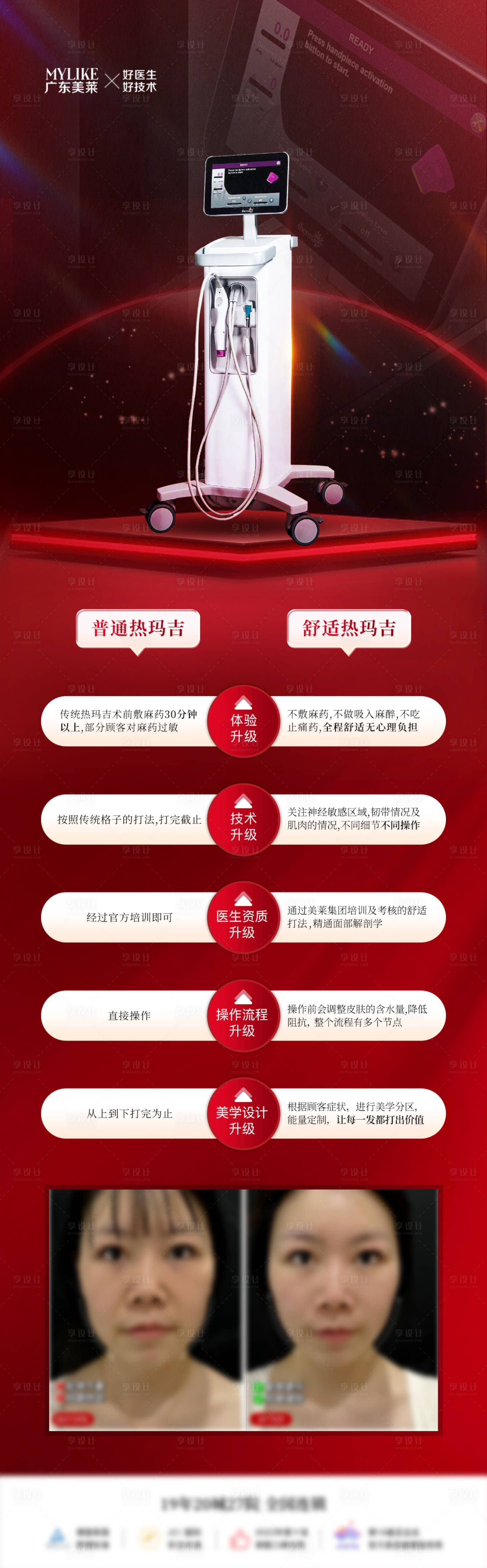 源文件下载【享设计】搜索编号：82840032439326667【热玛吉对比】