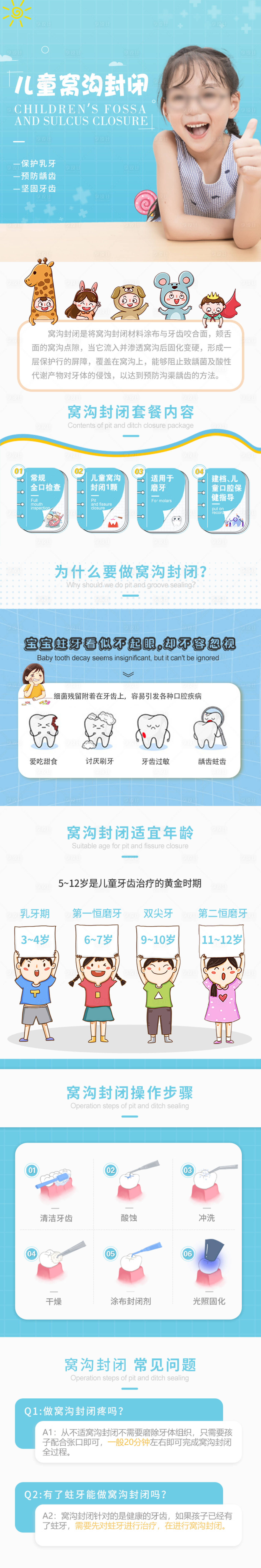 源文件下载【享设计】搜索编号：29200032695829184【儿童窝沟封闭详情页】