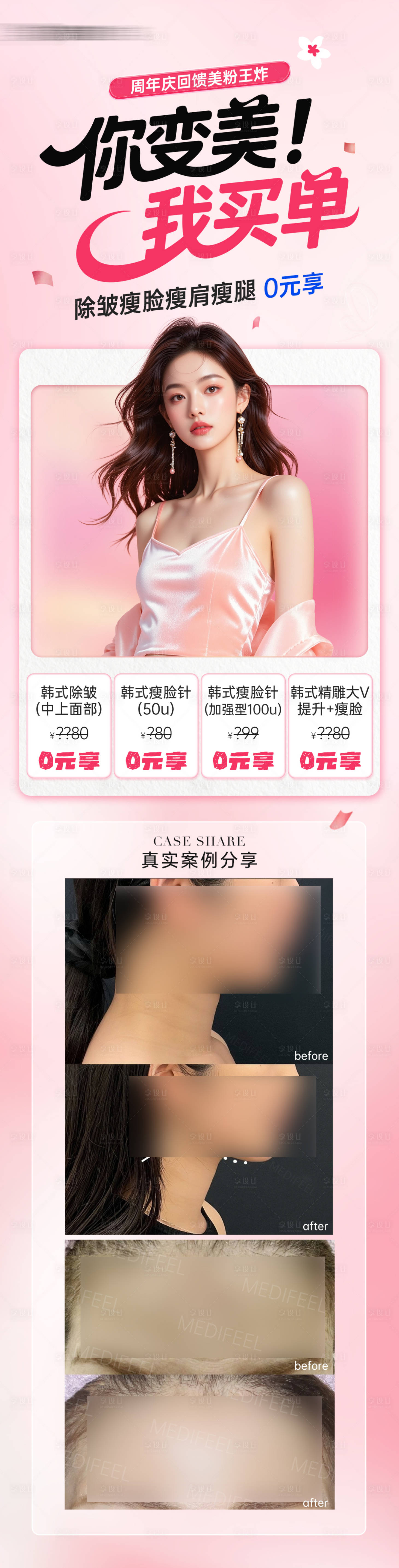 源文件下载【享设计】搜索编号：76860032702422334【医美进口除皱瘦脸0元享活动案例海报】