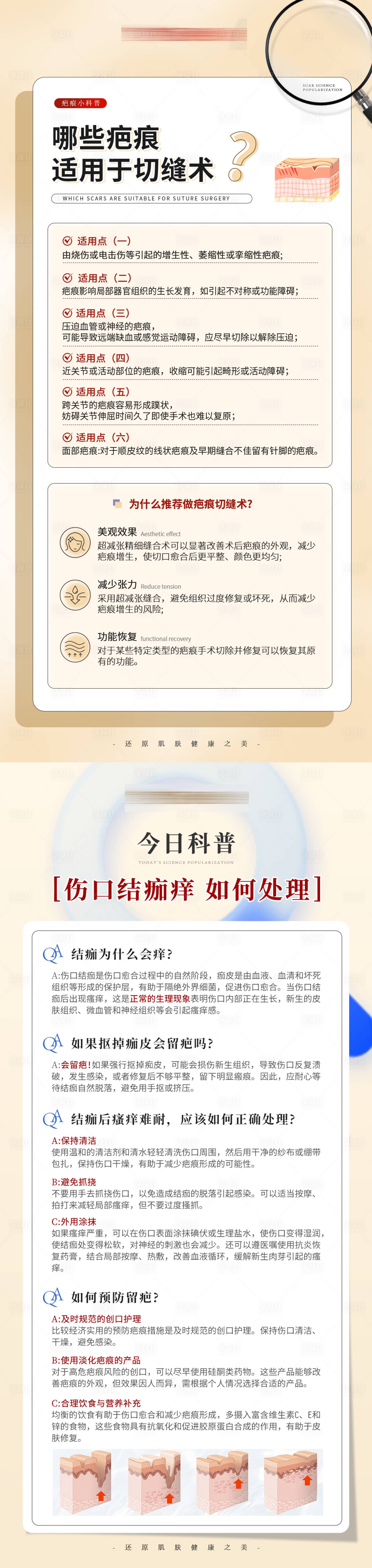 源文件下载【享设计】搜索编号：89330032328728489【疤痕胎记朋友圈科普小知识】