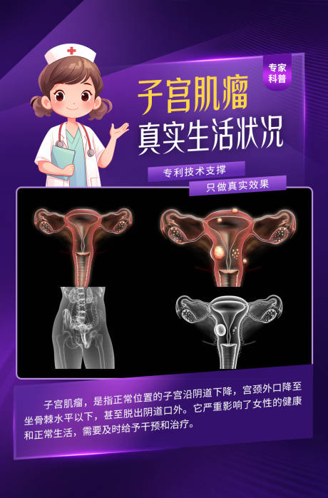 源文件下载【子宫肌瘤妇科检查宣传海报】编号：40510032290026976