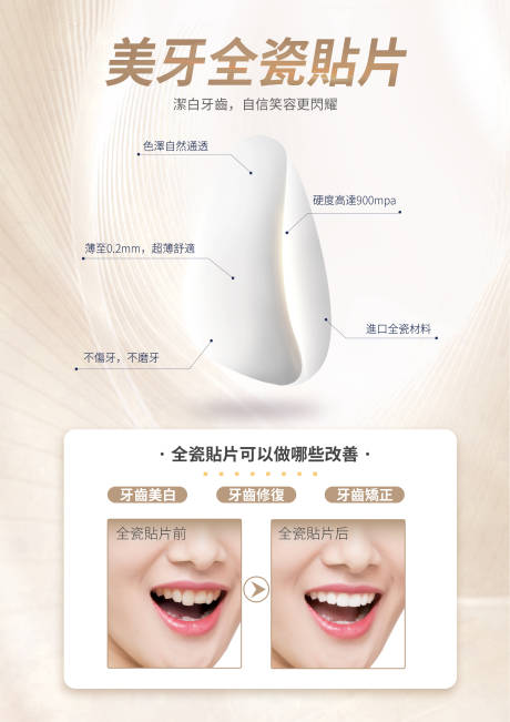源文件下載【享設計】搜索編號：83280032429378543【美牙全瓷貼片海報】
