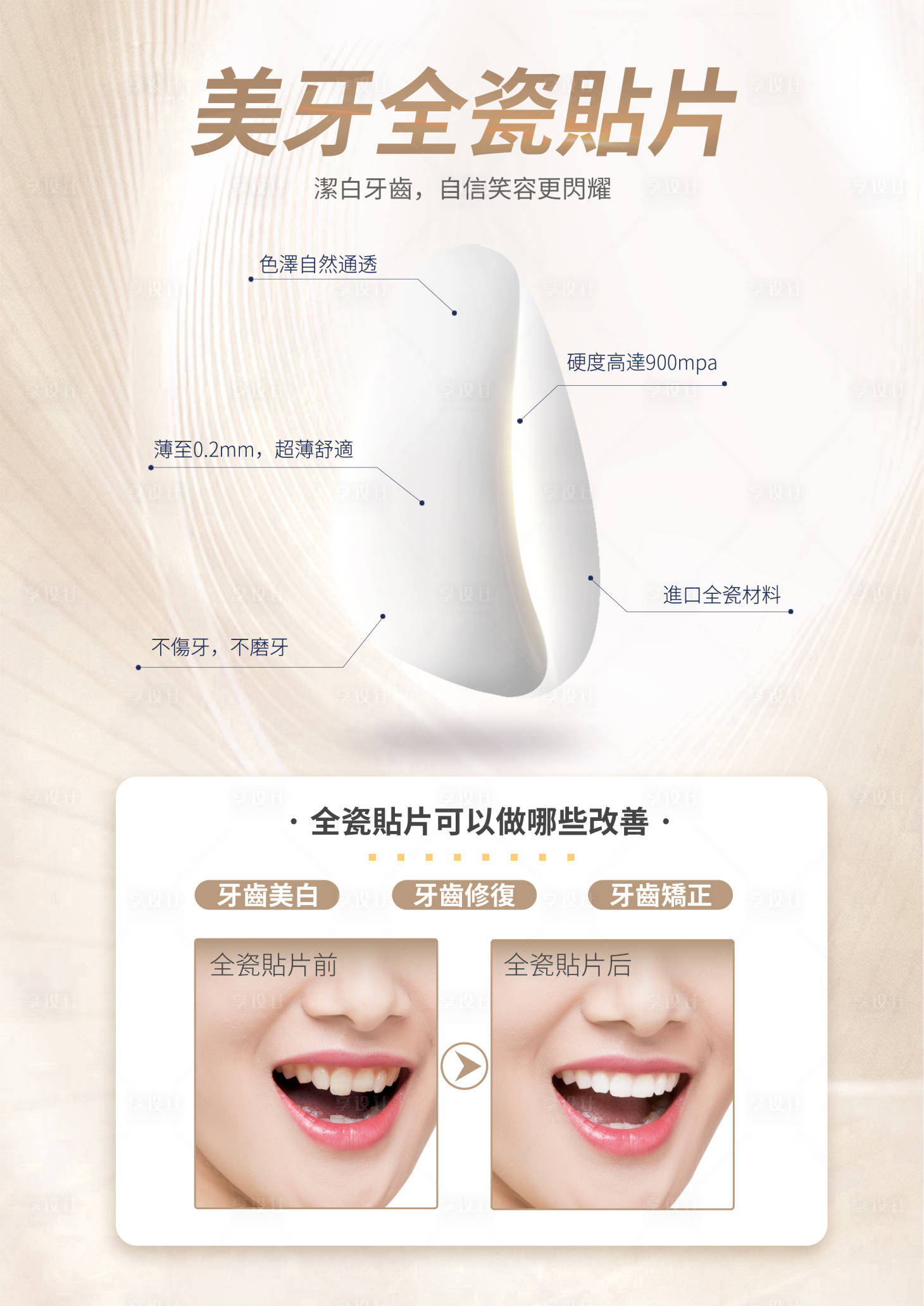 源文件下載【享設計】搜索編號：83280032429378543【美牙全瓷貼片海報】