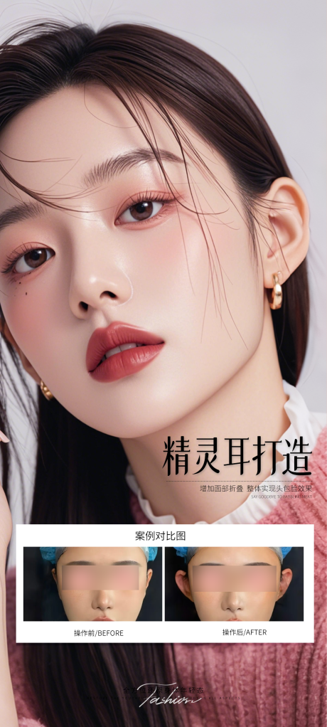 源文件下載【享設計】搜索編號：22910032595705948【醫美精靈耳朵案例海報】