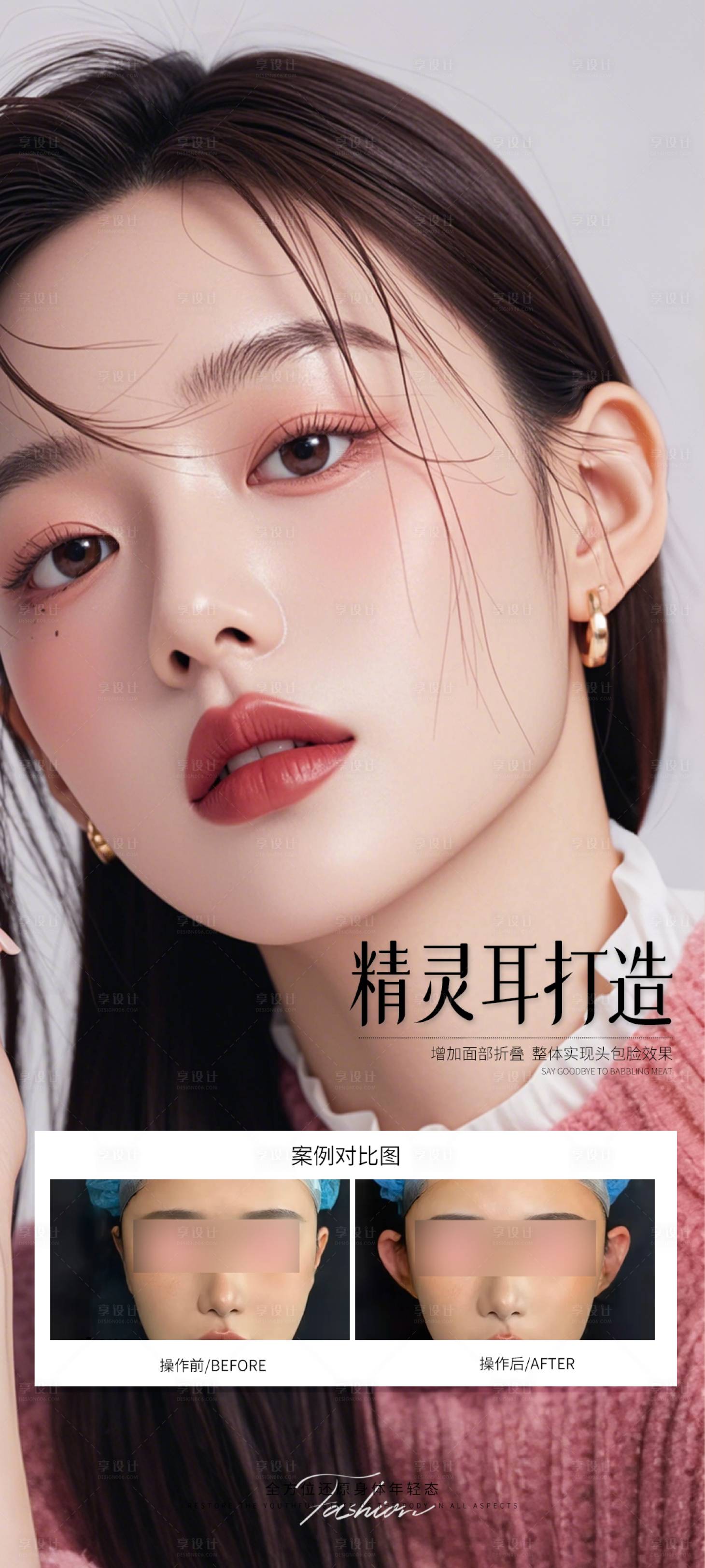 源文件下載【享設計】搜索編號：22910032595705948【醫(yī)美精靈耳朵案例海報】