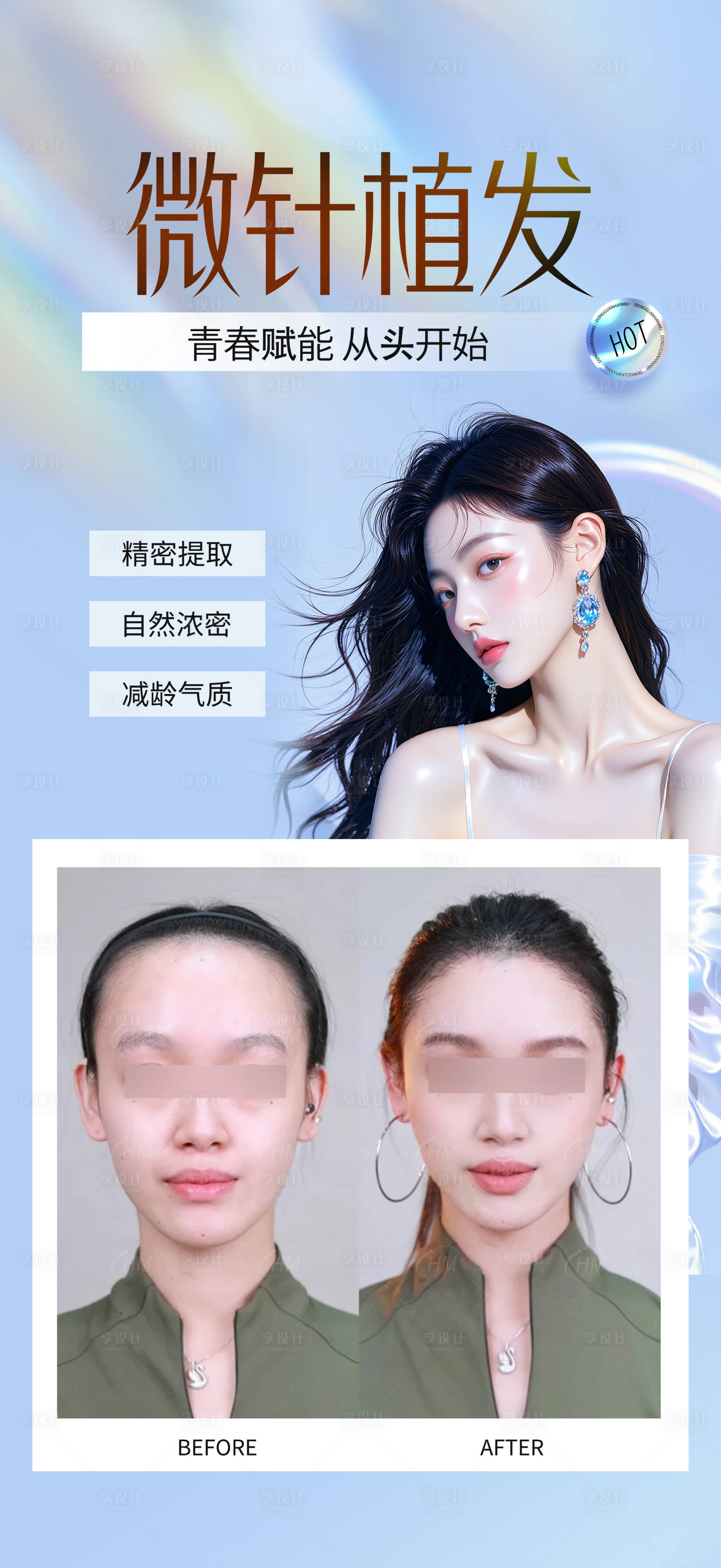 源文件下载【享设计】搜索编号：84560032601344840【微针植发】