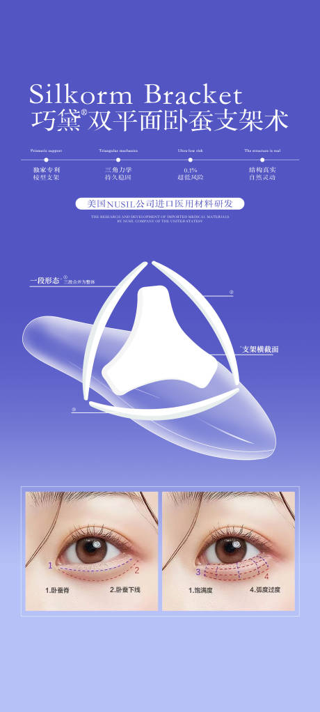 源文件下載【享設計】搜索編號：32260032491416084【雙平面臥蠶支架術】