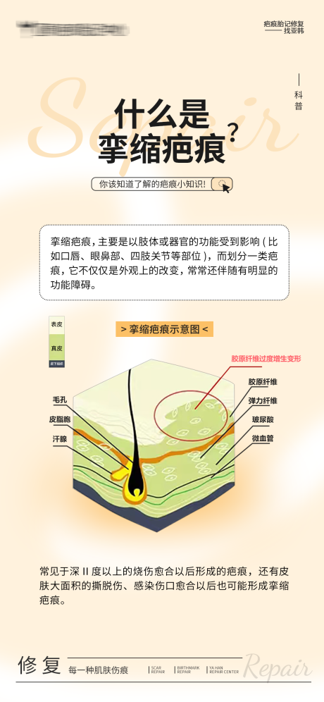 源文件下载【享设计】搜索编号：73520032455307730【什么是挛缩疤痕】
