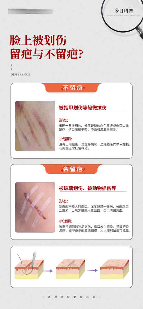 源文件下載【享設(shè)計(jì)】搜索編號(hào)：38230032328843647【臉上被劃傷留疤與不留疤】