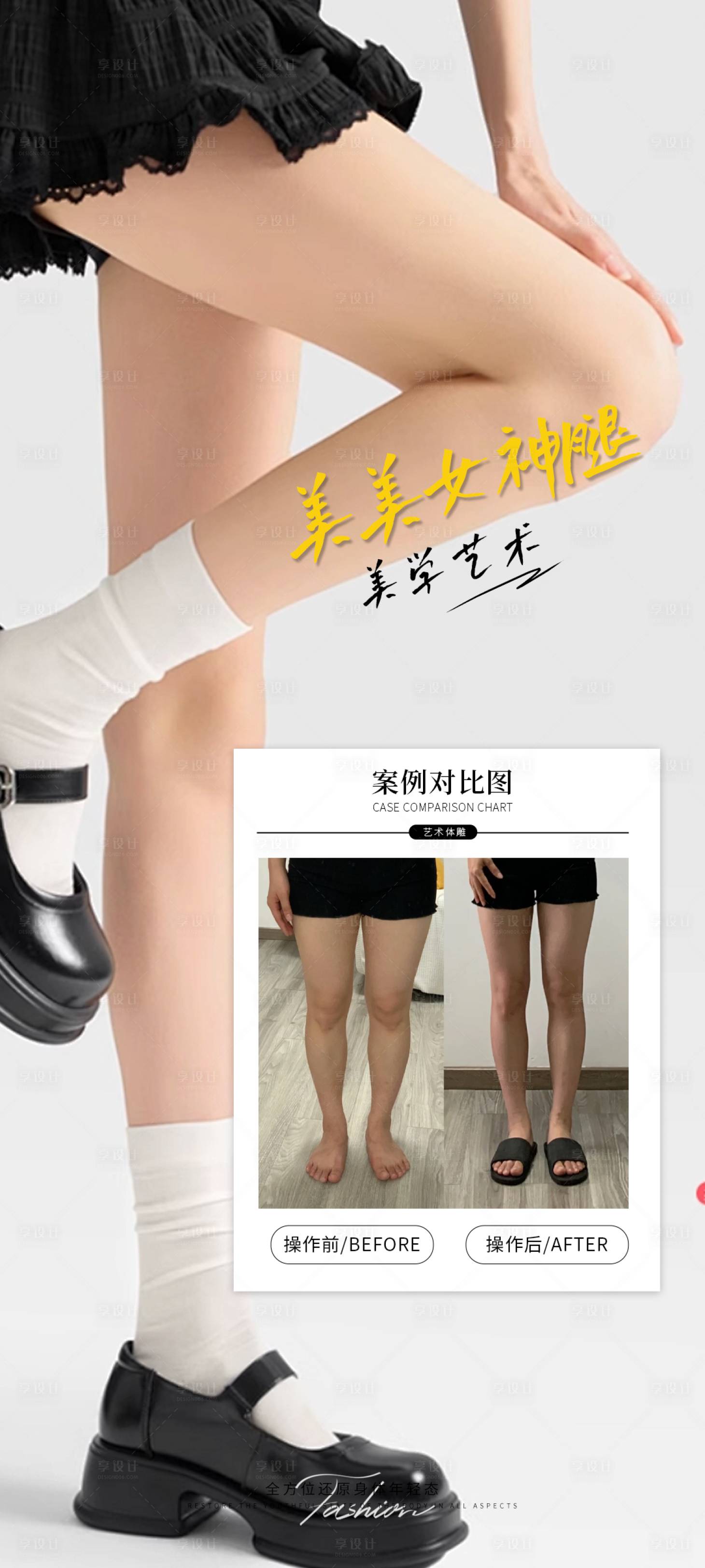 源文件下载【享设计】搜索编号：10690032813997890【女神腿案例宣传海报】