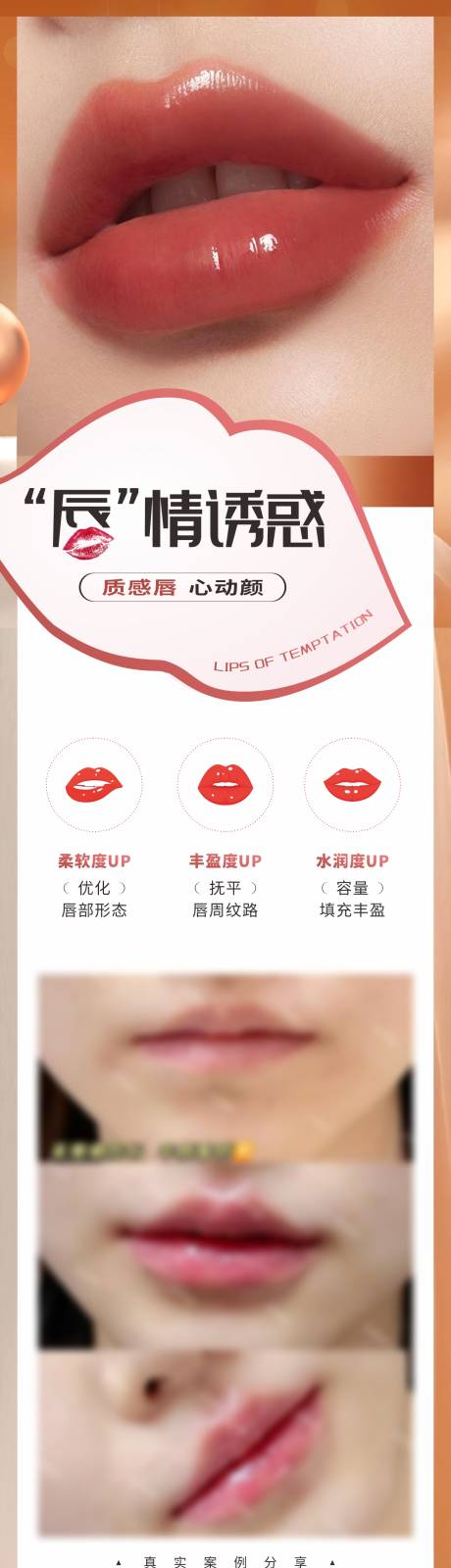 源文件下载【享设计】搜索编号：40880032438674789【医美唇部塑形案例创意海报】