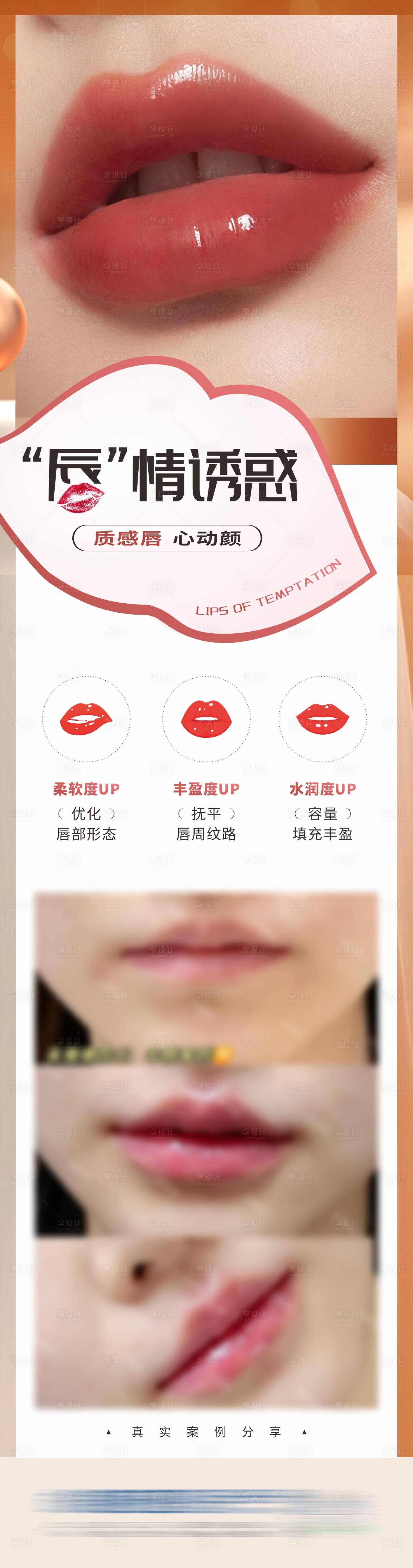 源文件下载【享设计】搜索编号：40880032438674789【医美唇部塑形案例创意海报】