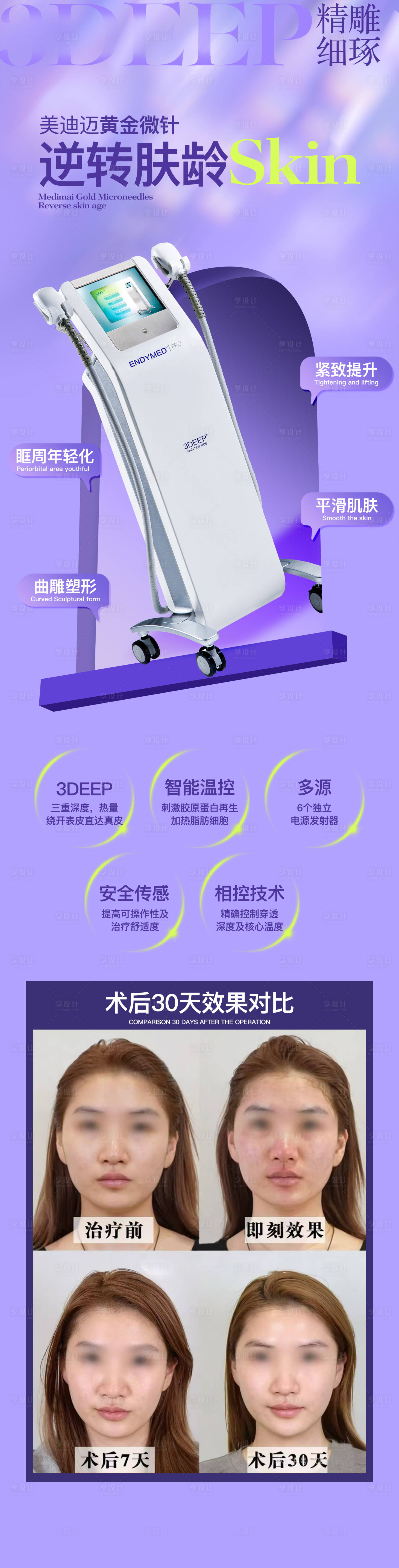源文件下载【享设计】搜索编号：47030032746693387【美迪迈黄金微针科普】