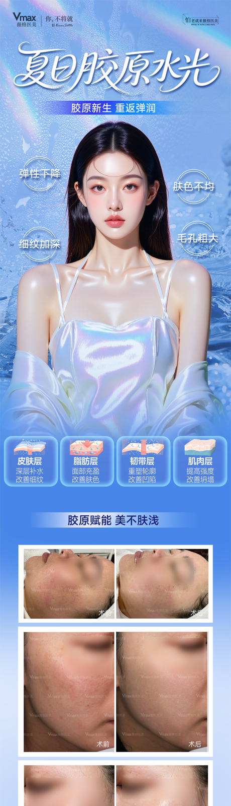 源文件下载【享设计】搜索编号：67170032690359317【夏日胶原水光案例抗衰胶原蛋白医美海报】