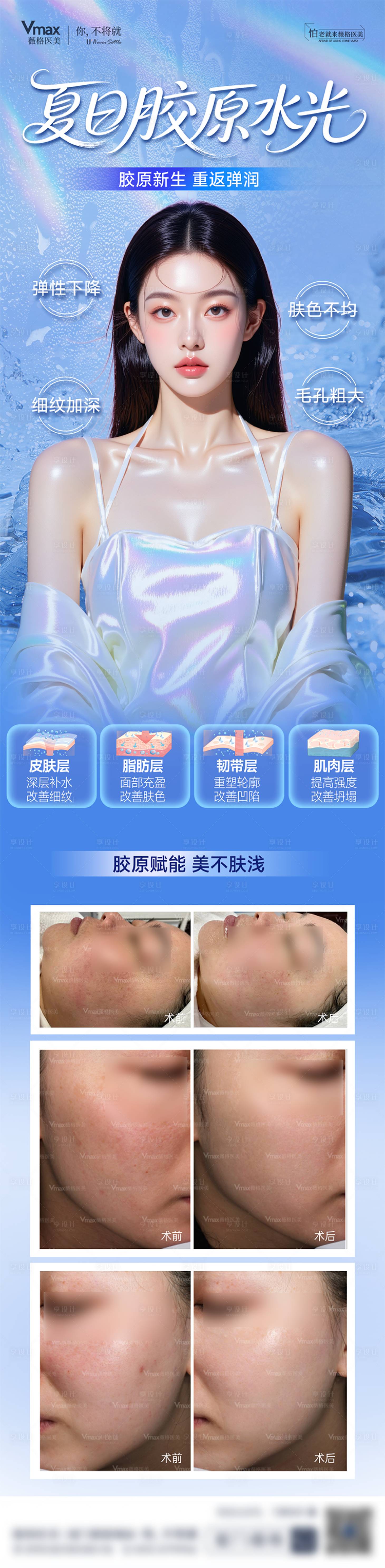 源文件下载【享设计】搜索编号：67170032690359317【夏日胶原水光案例抗衰胶原蛋白医美海报】