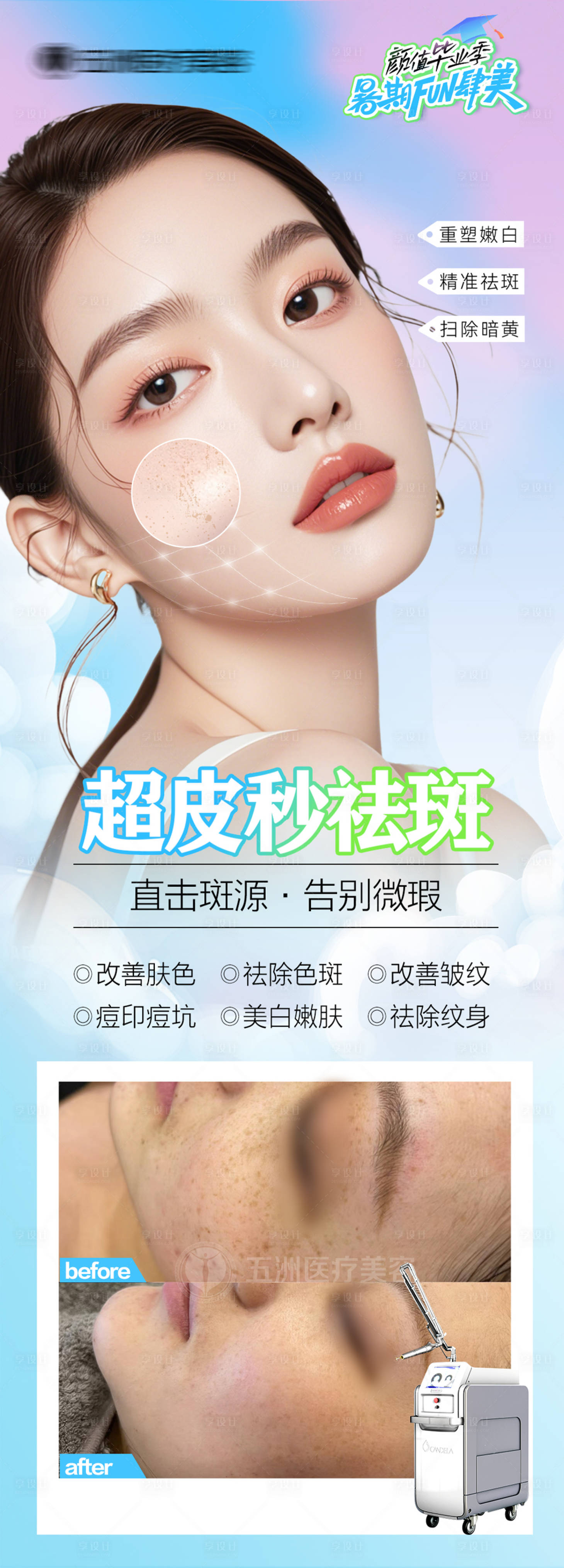 源文件下载【享设计】搜索编号：70110032752379164【医美祛斑案例超皮秒海报】