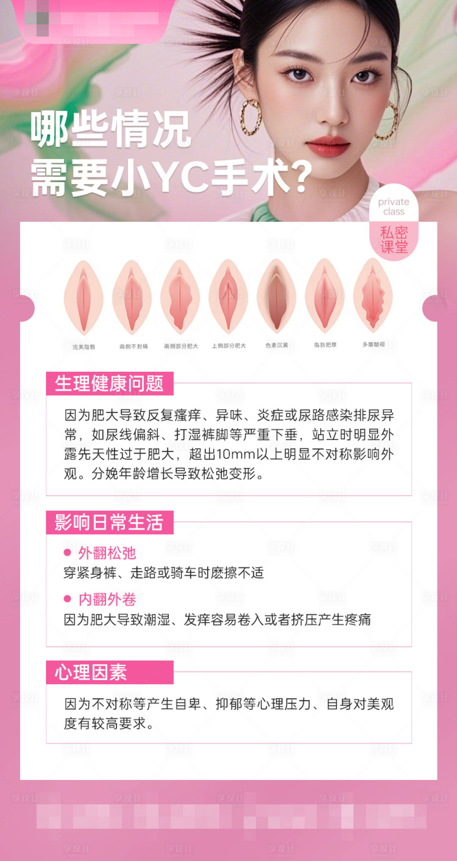 源文件下载【享设计】搜索编号：65060032296723702【哪些情况需要小YC手术】