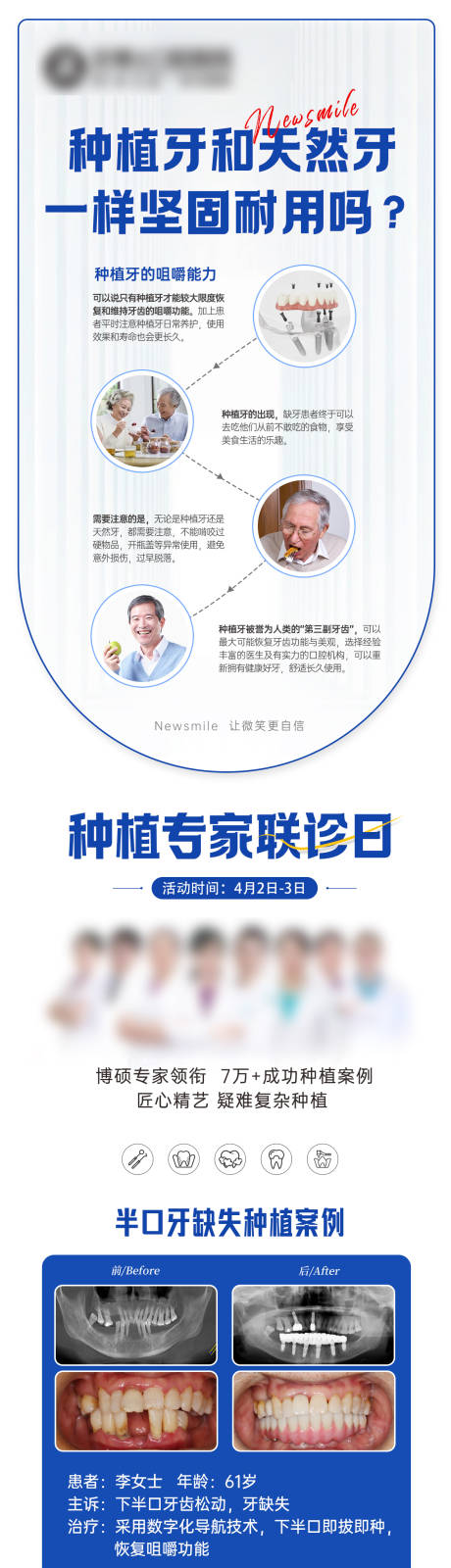源文件下载【享设计】搜索编号：47160032824017703【口腔种植科普海报】