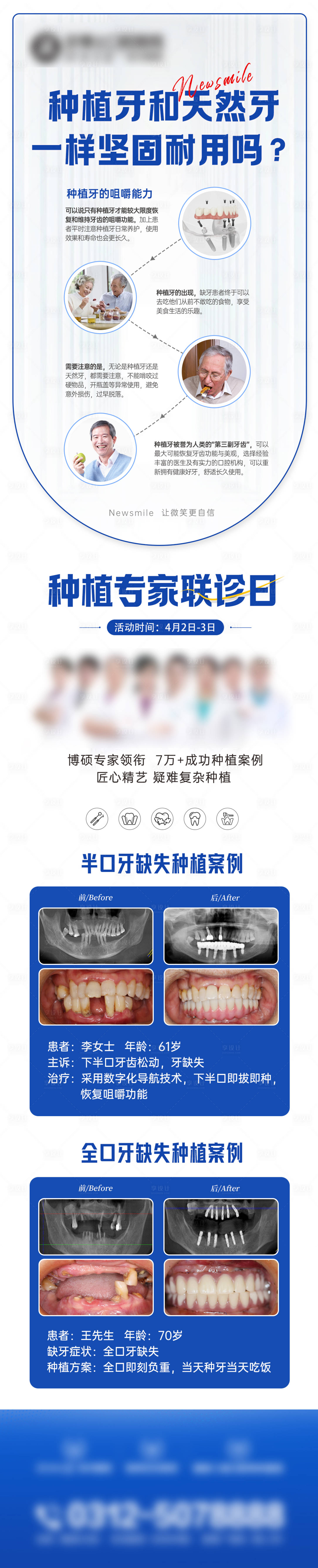 源文件下载【享设计】搜索编号：47160032824017703【口腔种植科普海报】