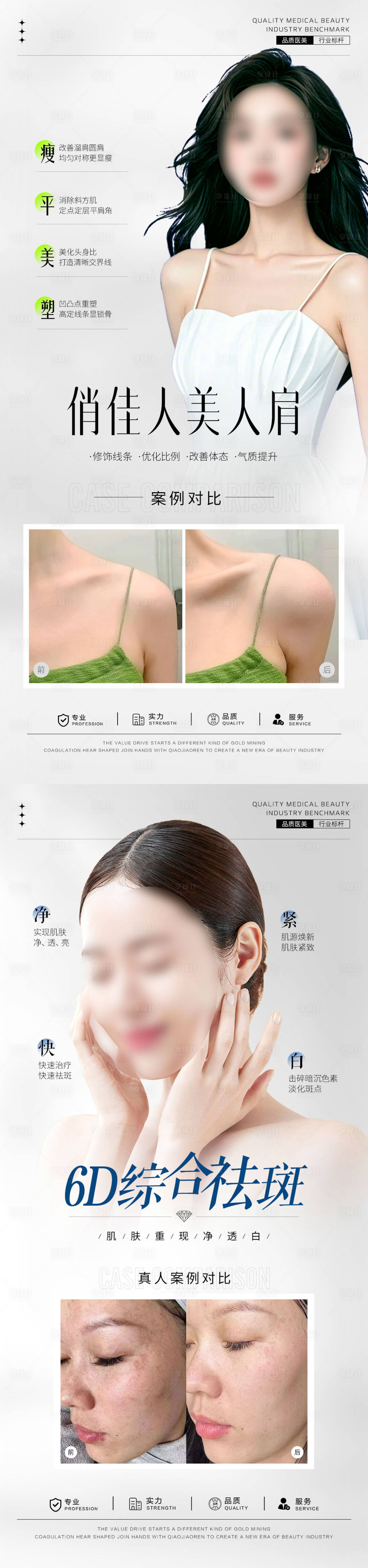 源文件下載【享設(shè)計】搜索編號：57500033117642501【美人肩案例對比海報】