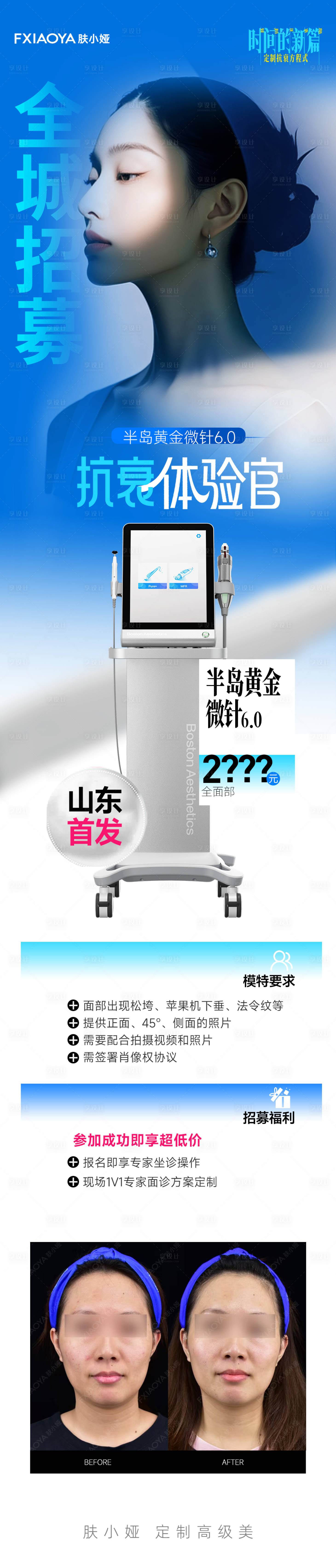 源文件下載【享設計】搜索編號：33790033076675697【黃金微針招募海報】