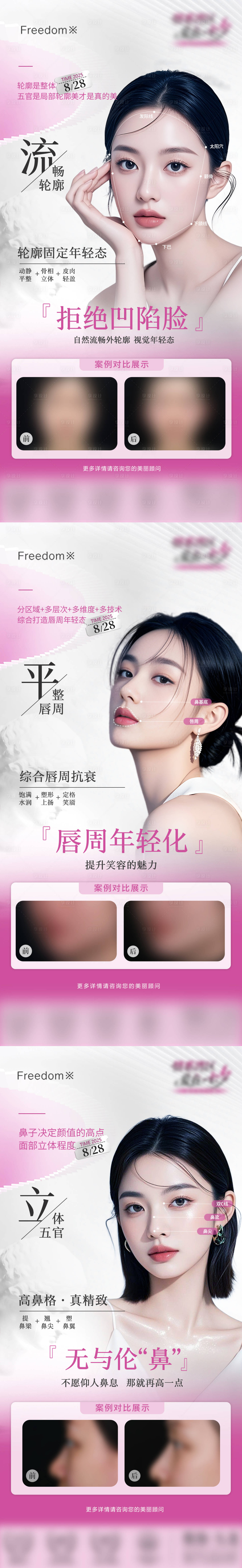 源文件下载【享设计】搜索编号：30670032885769897【医美面部眼鼻案例】