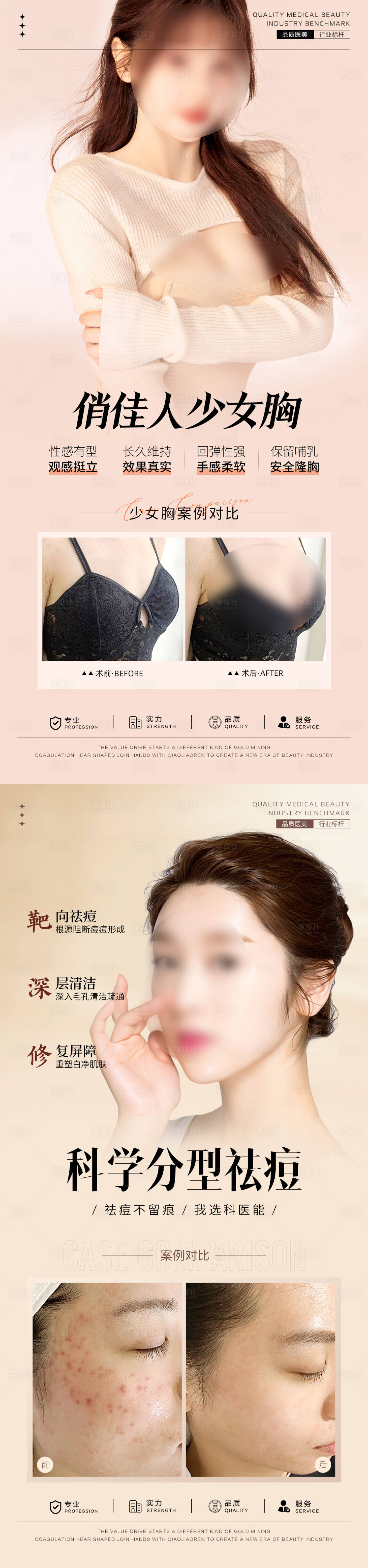 源文件下载【享设计】搜索编号：89440033117596796【隆胸案例对比海报】
