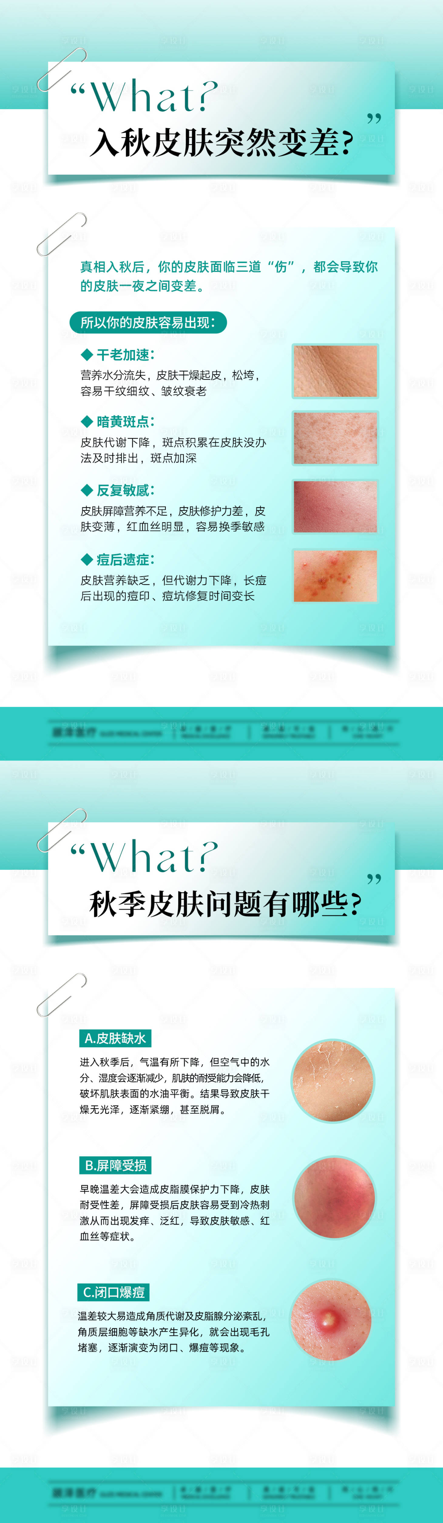 源文件下载【享设计】搜索编号：80510032879705355【入秋皮肤突然变差科普】