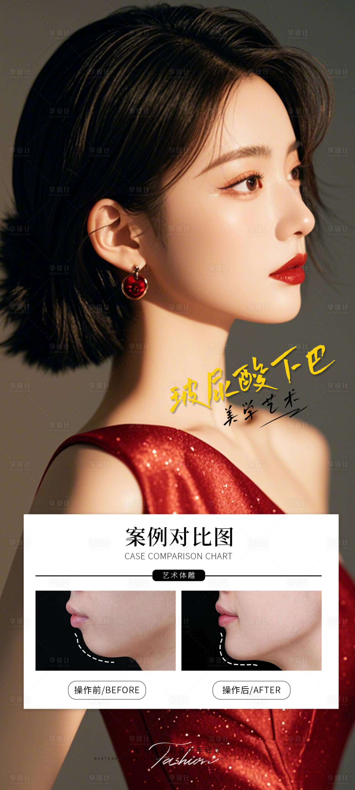 源文件下载【享设计】搜索编号：55600032947203140【玻尿酸下巴案例对比海报】