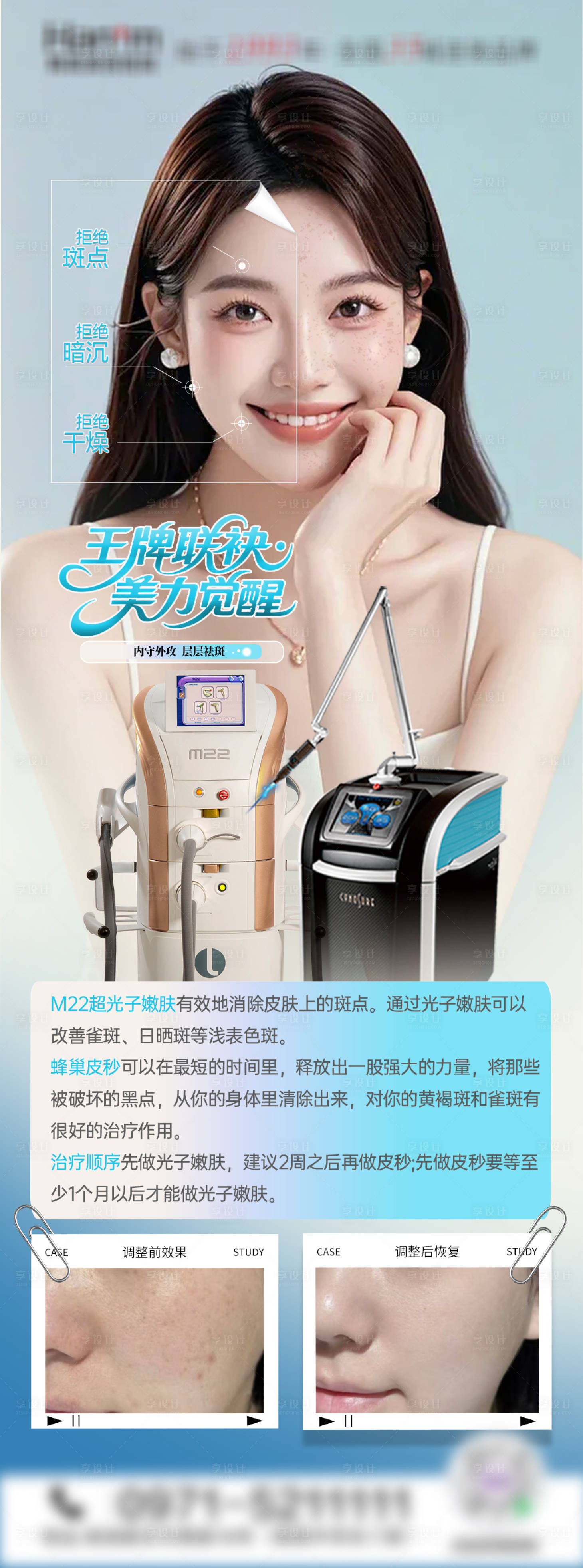 源文件下載【享設(shè)計(jì)】搜索編號(hào)：54320032883664961【醫(yī)美祛斑組合宣傳展架】
