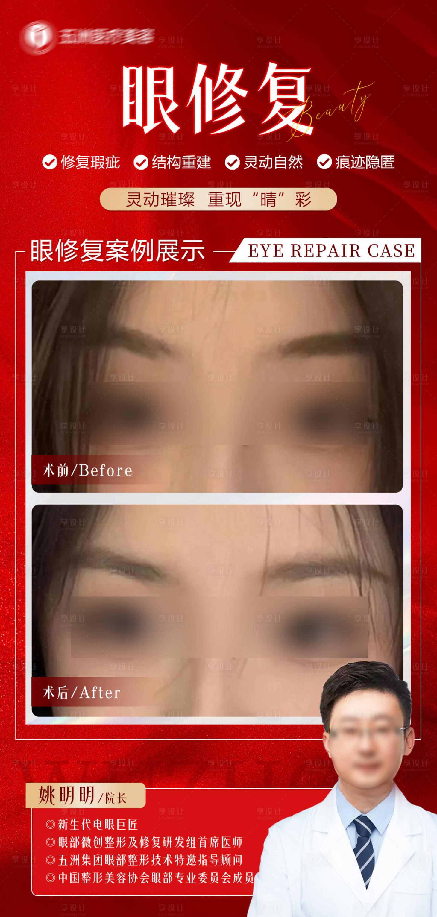 源文件下载【享设计】搜索编号：52930032829604418【眼修复案例对比】