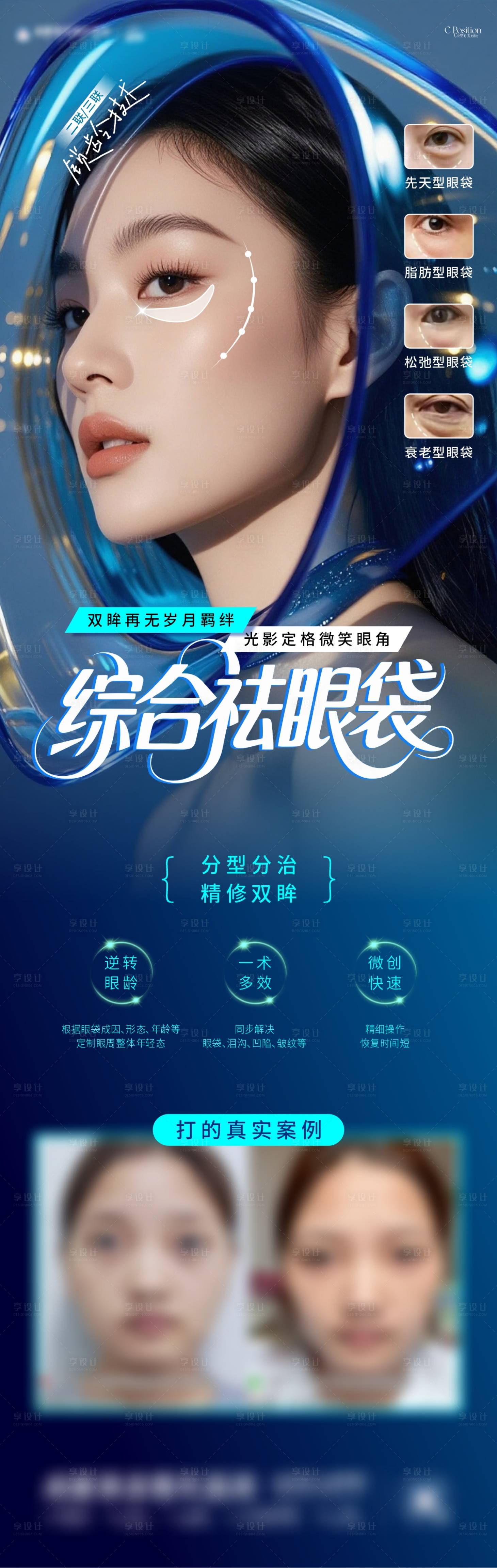 源文件下載【享設(shè)計】搜索編號：18260033182832058【醫(yī)美祛眼袋海報】