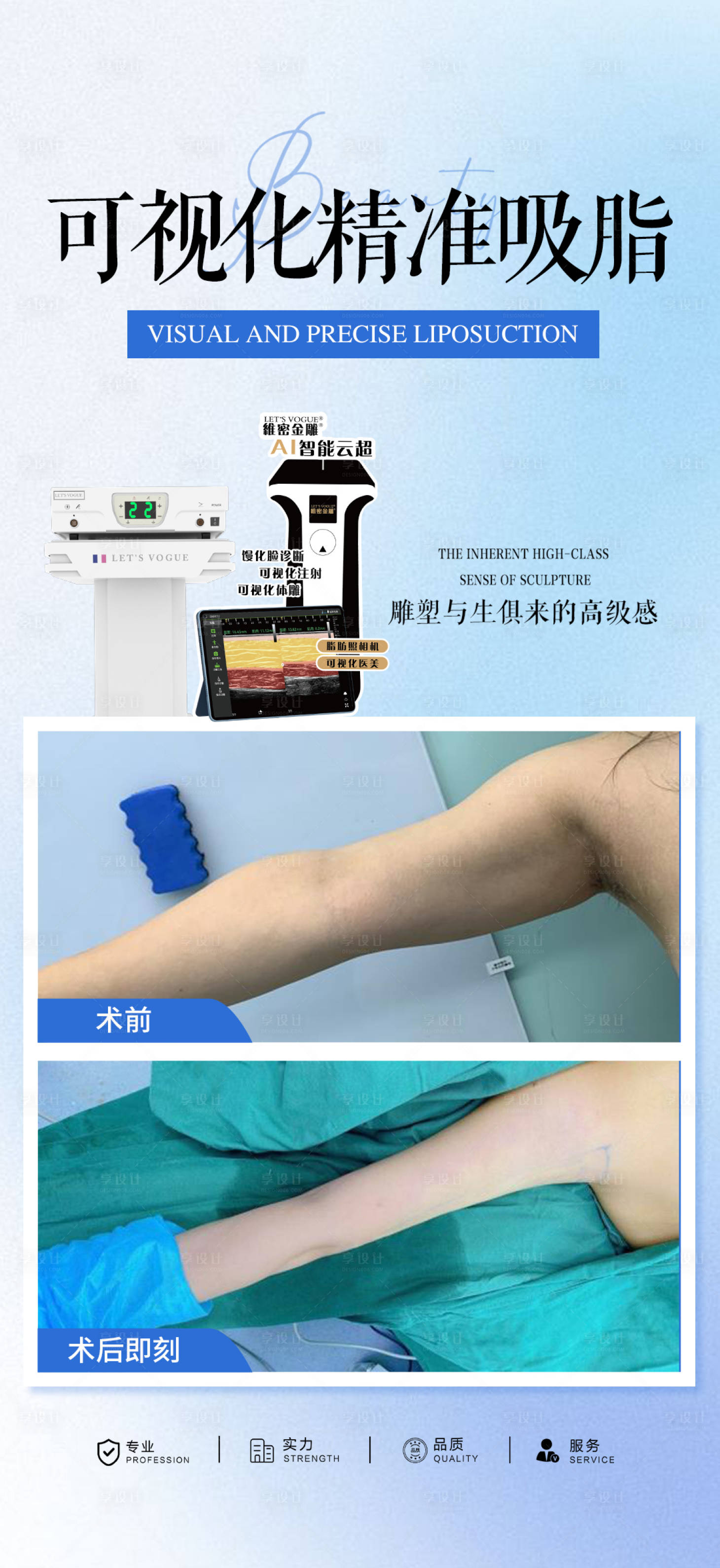源文件下载【享设计】搜索编号：39500032878775769【可视化精准吸脂】