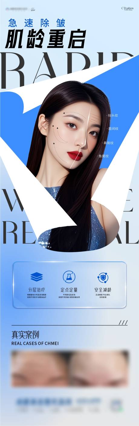 源文件下載【享設(shè)計(jì)】搜索編號(hào)：37450033118666253【醫(yī)美除皺海報(bào)】