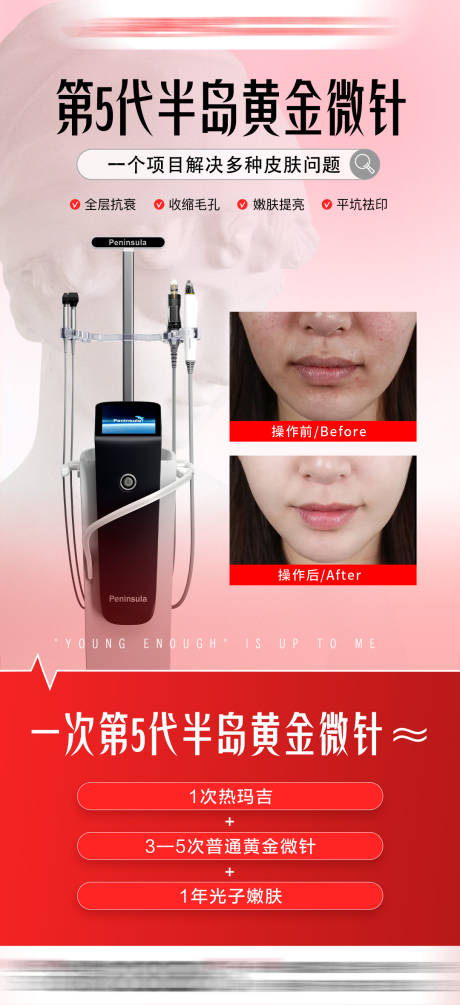 源文件下載【享設計】搜索編號：81600033096815893【半島黃金微針案例海報】
