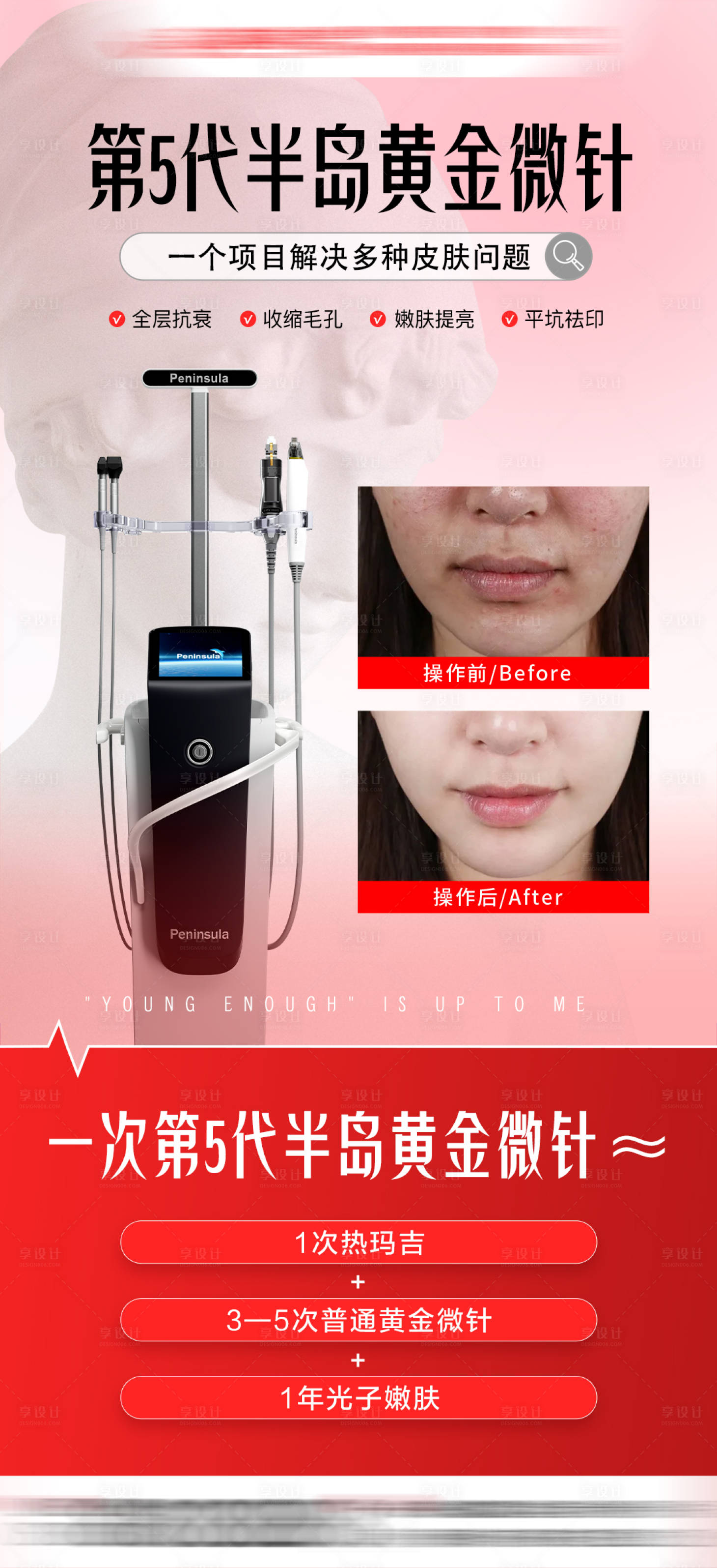 源文件下載【享設計】搜索編號：81600033096815893【半島黃金微針案例海報】