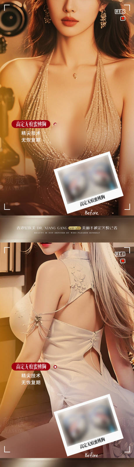 源文件下載【享設計】搜索編號：83390032955249763【醫美豐胸項目案例對比海報】