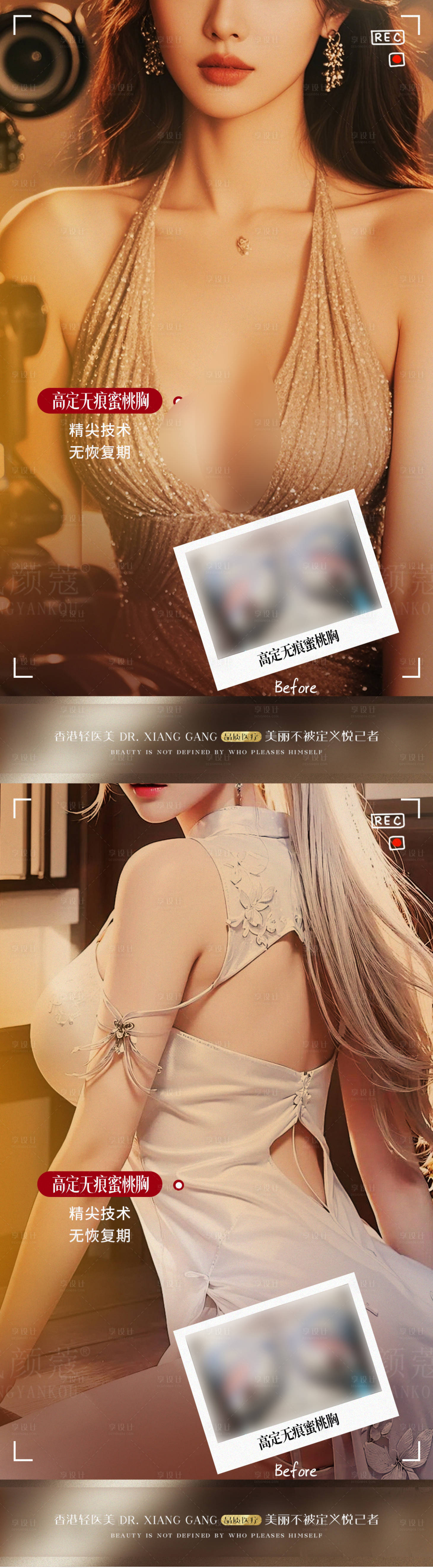 源文件下載【享設計】搜索編號：83390032955249763【醫美豐胸項目案例對比海報】