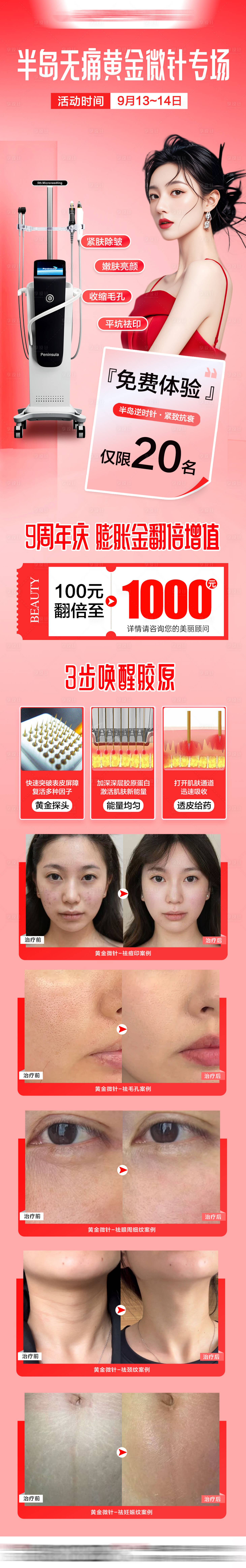 源文件下載【享設計】搜索編號：97120033057978324【半島黃金微針案例】