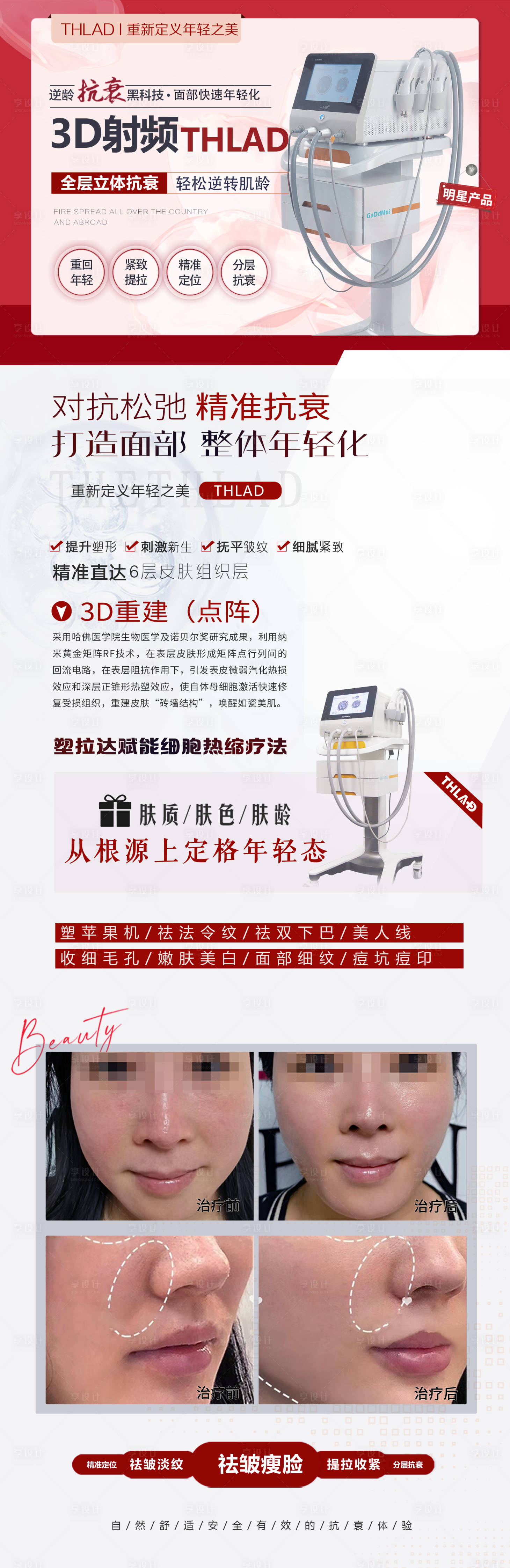 源文件下载【享设计】搜索编号：68150033062072557【医美仪器展板展架】