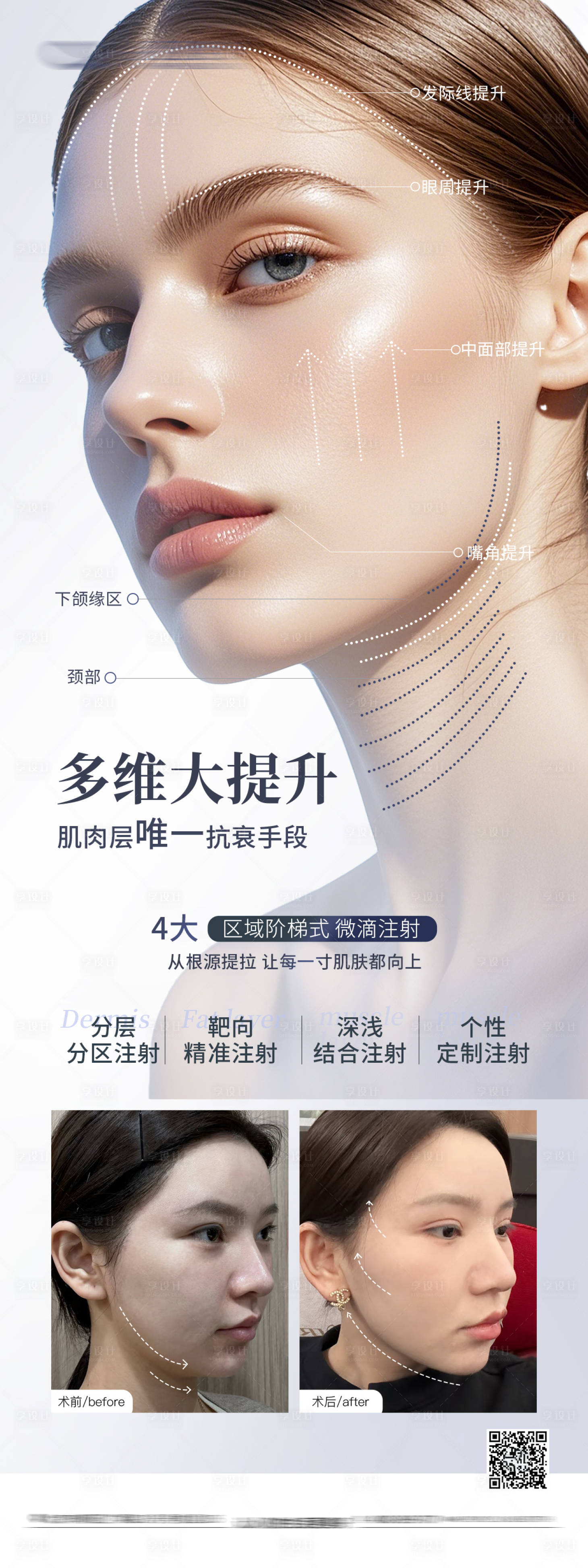 源文件下载【享设计】搜索编号：28740032897992891【面部提升案例对比海报】
