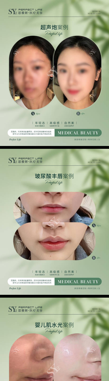 源文件下载【享设计】搜索编号：29410033326132232【对比图标准格式医美对比图疗程对比】