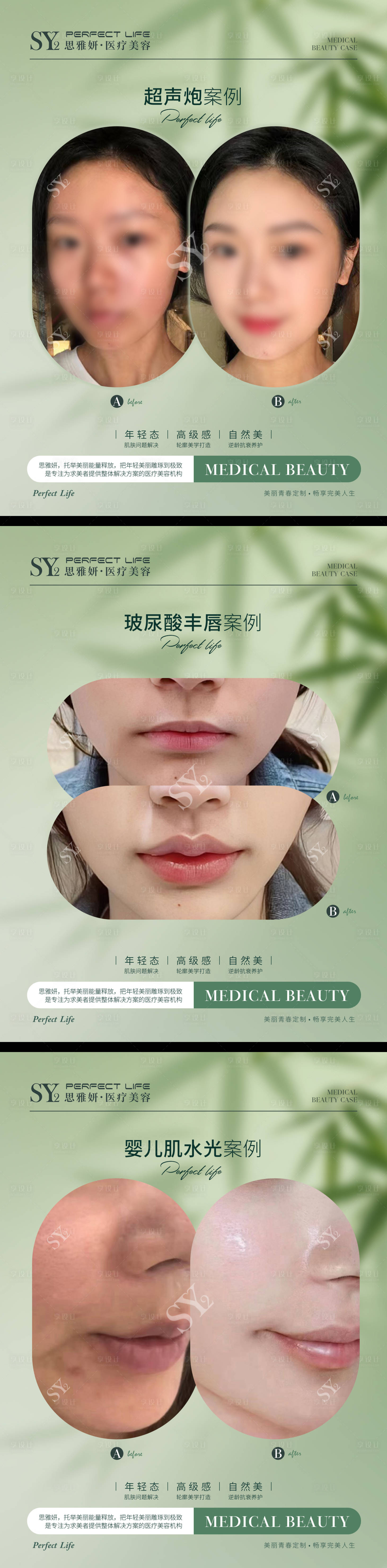 源文件下载【享设计】搜索编号：29410033326132232【对比图标准格式医美对比图疗程对比】