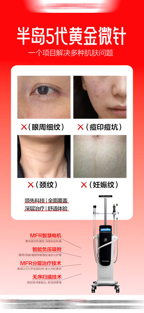 源文件下載【享設(shè)計】搜索編號：16100033036031906【半島黃金微針】