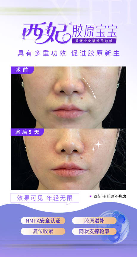 源文件下載【享設(shè)計(jì)】搜索編號(hào)：55530032895285491【醫(yī)美膠原案例】